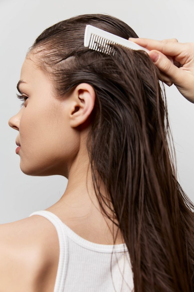 Perdida de cabello en mujeres