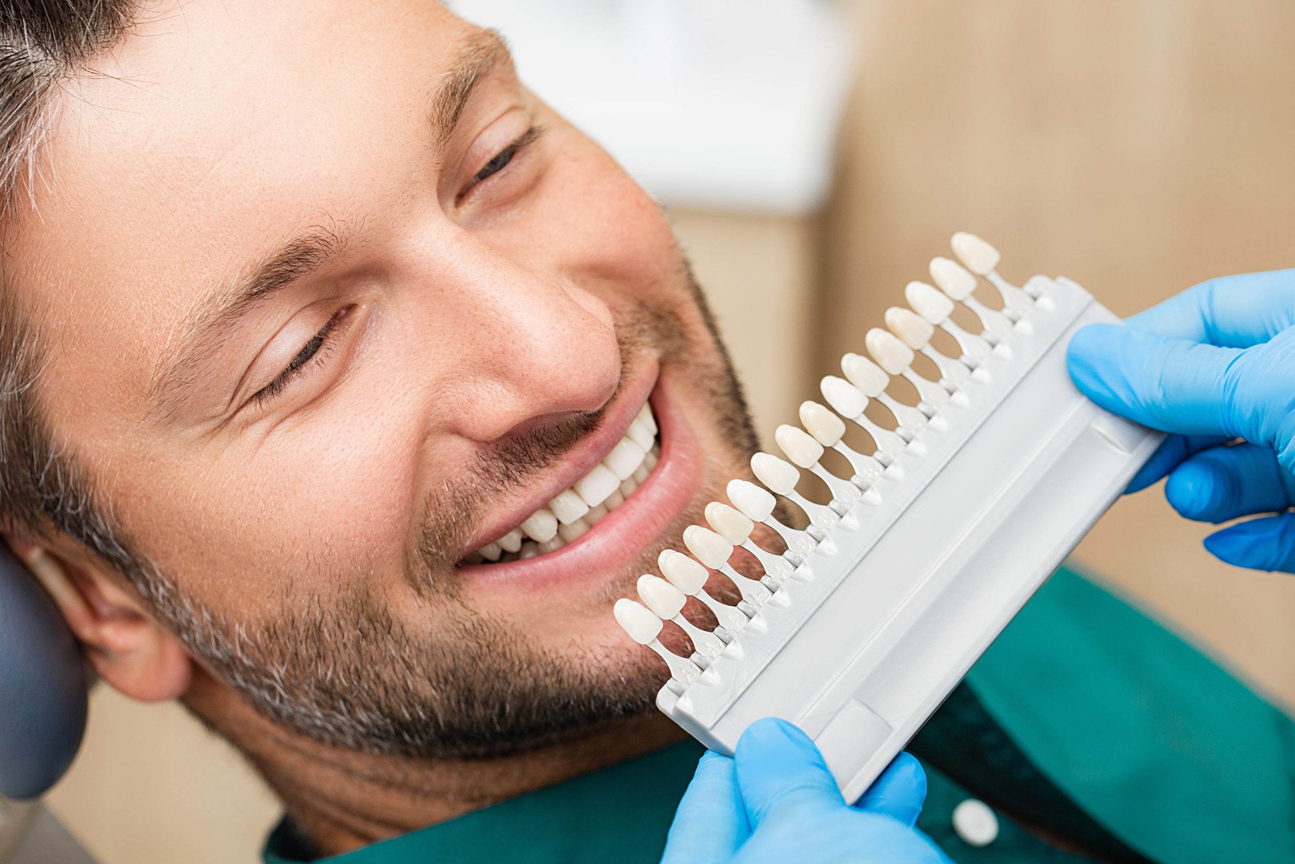Cómo quitar las manchas en los dientes