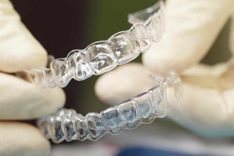 alternativas a los brackets