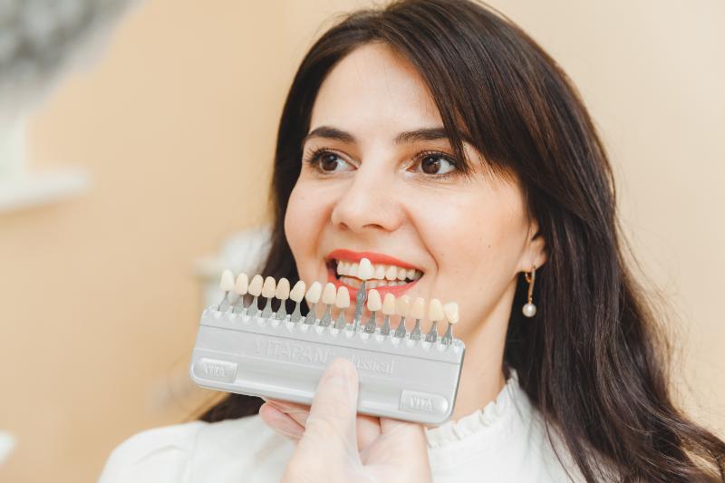 carillas para dientes desgastados