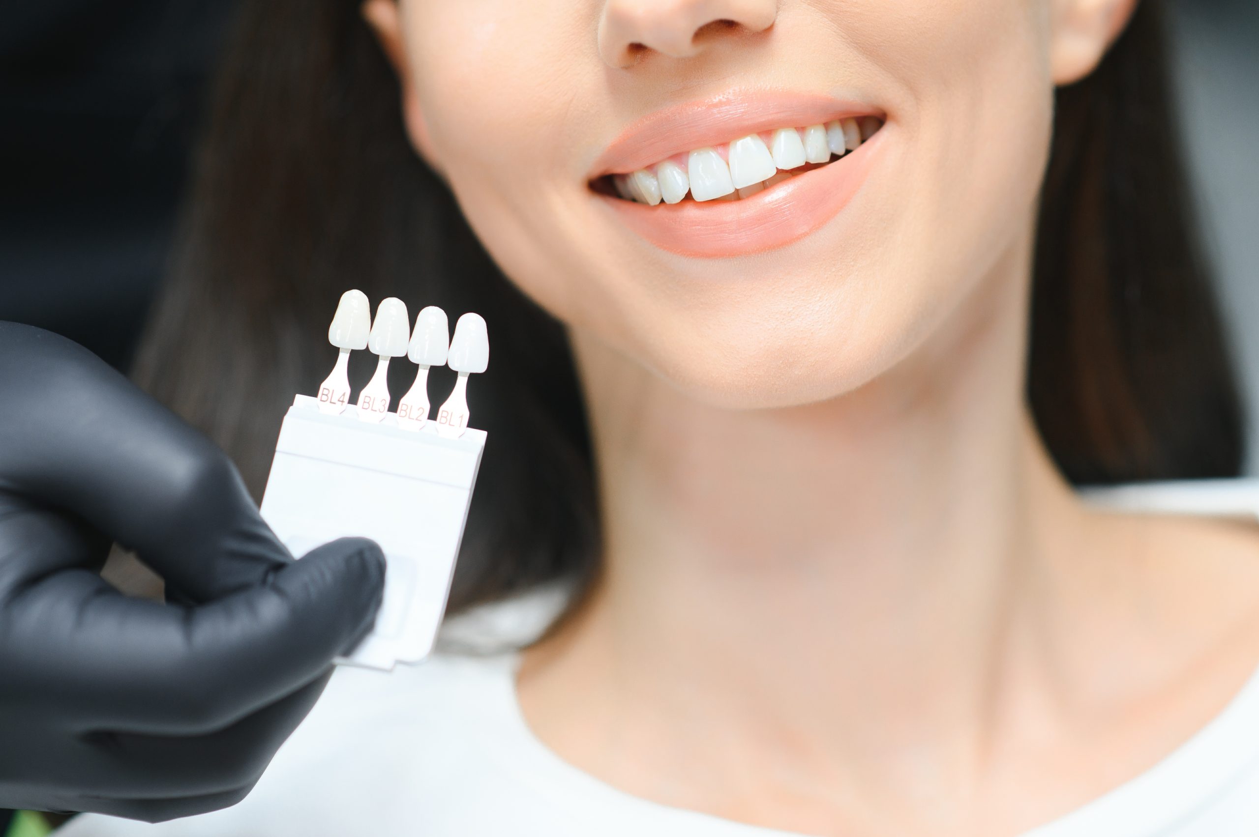 Dientes desiguales