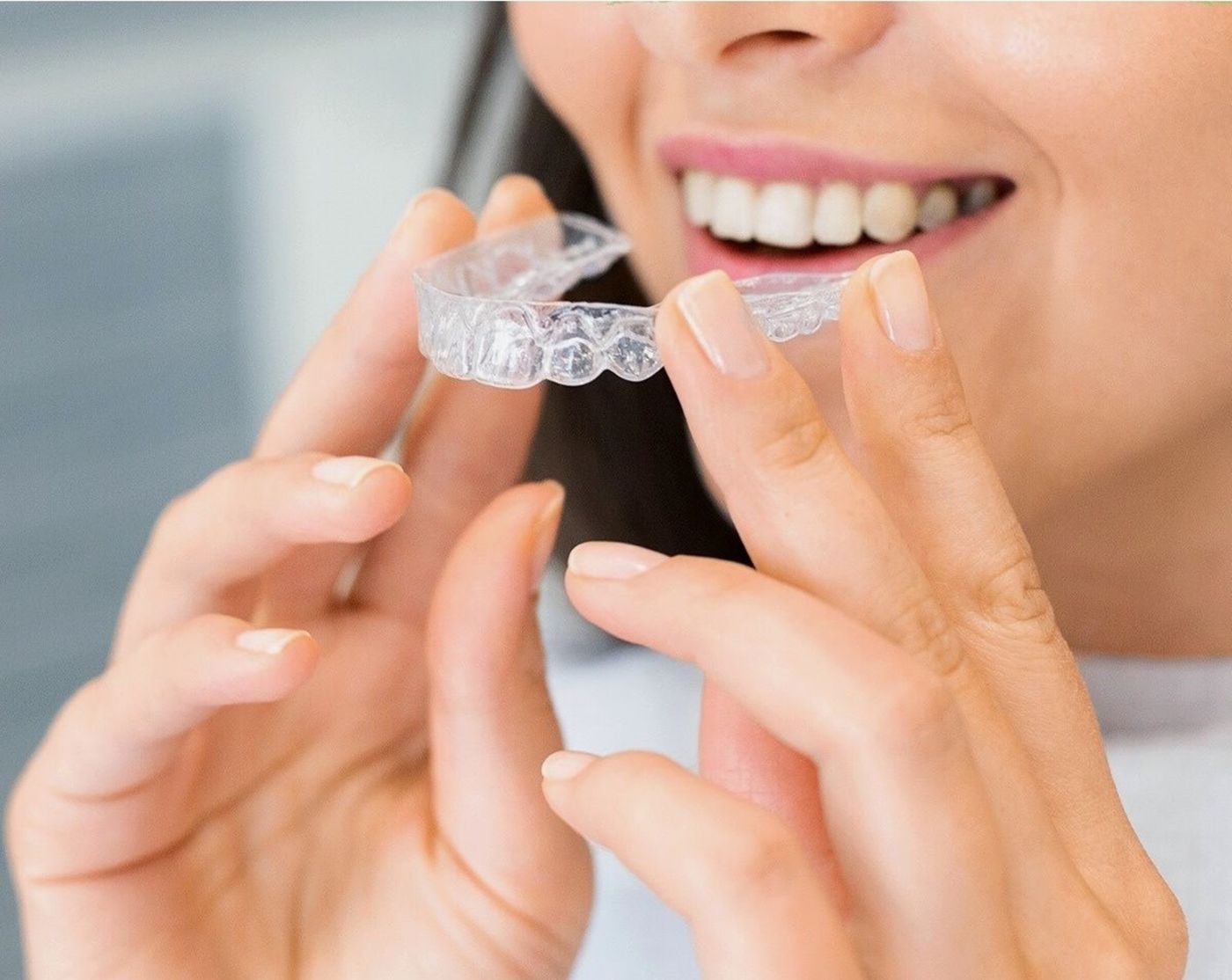 Alineador transparente, una de las opciones de ortodoncia para cerrar un diastema