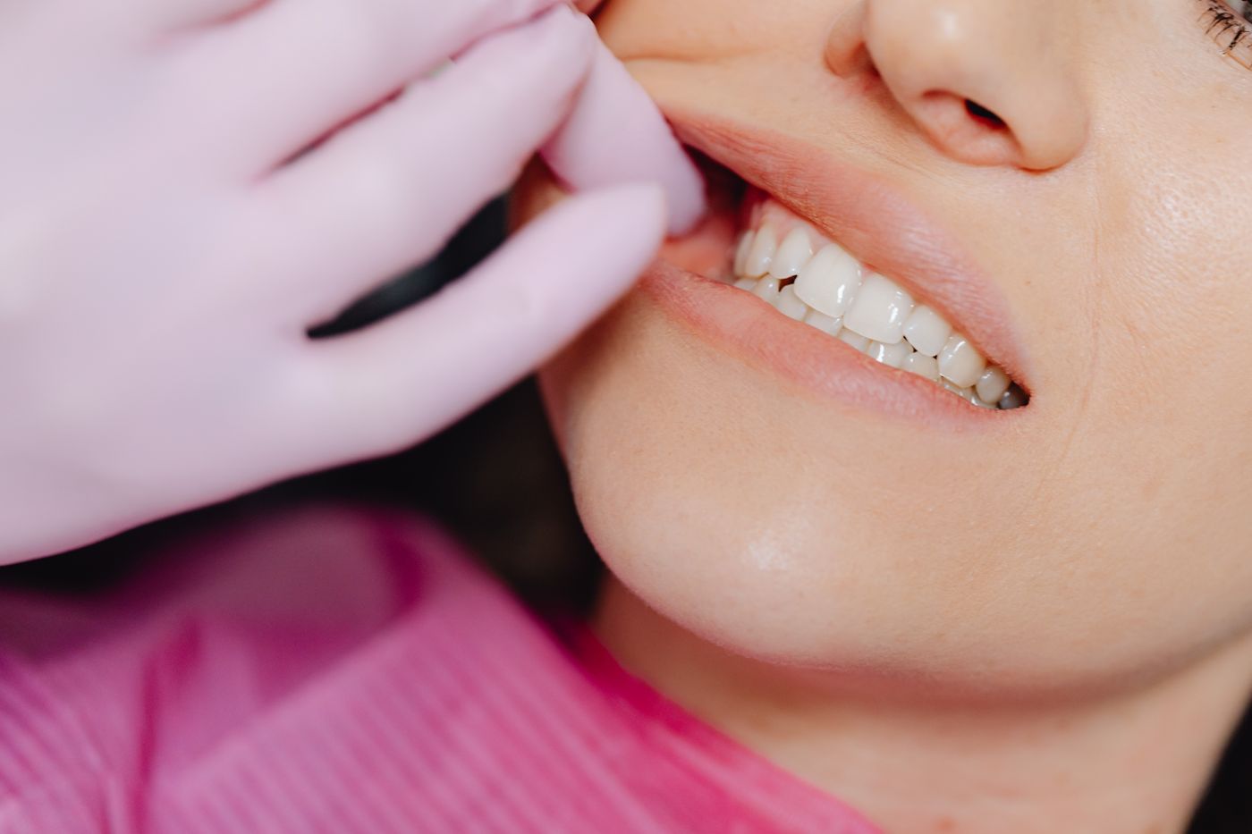 Revisión del hueco entre los dientes en la consulta