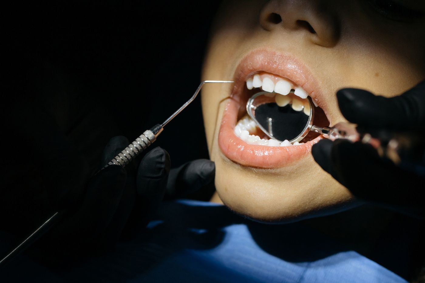 Revisión de la mordida con espejo dental en el sillón