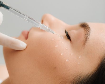 Tratamiento facial con microinyecciones para mejorar la hidratación y calidad de la piel